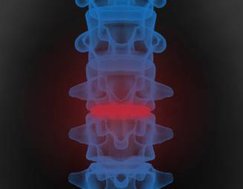 Osteoporoz Nasıl Meydana Gelir?